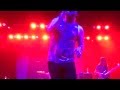 Say Anything Live! Surgically Removing the Tracking Device & A Boston Peace 2014