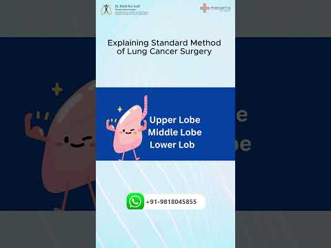 Standard Method of Lung Cancer Surgery | Dr Belal Bin Asaf