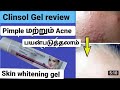 Clinsol Gel Review In Tamil Best Cream For Pimples And Acne Best Skin Whitening Cream