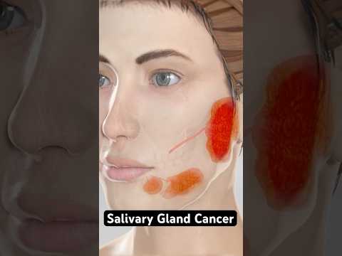 Cancer in your salivary glands (3D Animation)