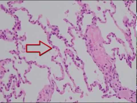 Histology of the Lung