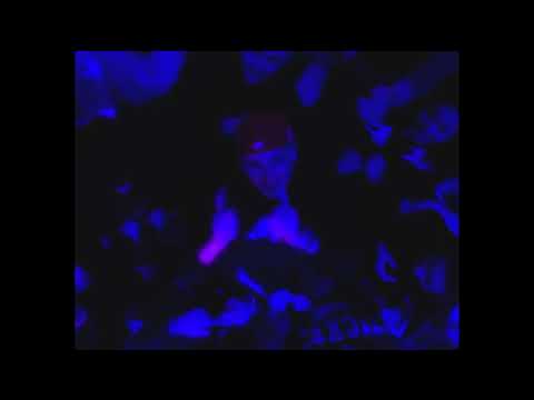 Jimilian x Josef Type Beat - "Hun Vil" | Afrotrap Type Beat 2023