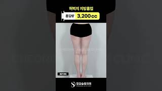 허벅지 전후 비교컷 🔍