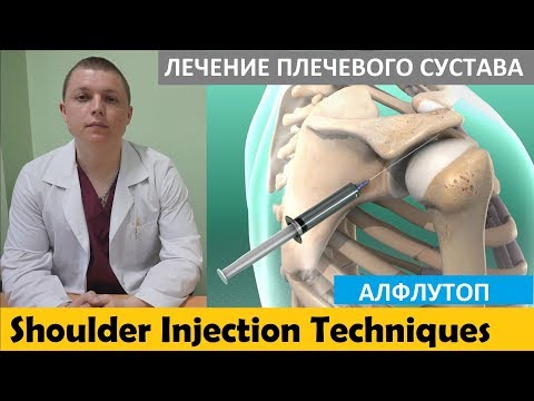 Ревматоидный узел на локтевом суставе Сильная рвота при остеохондрозе
