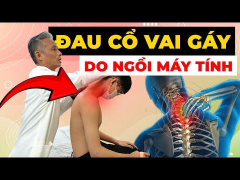 TÊ CỔ, ĐAU VAI: Hậu Quả Khủng Khiếp Của Ngồi Máy Tính QUÁ NHIỀU
