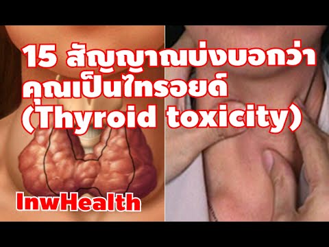 คะแนน badov ของความแรง ความอ่อนแอในผู้ชายที่เป็นโรคเบาหวาน