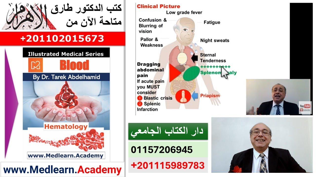 Chronic Myeloid Leukemia (CML)  #cme #internal_medicine #medical #usmle #محاضرات_باطنة #USMLE