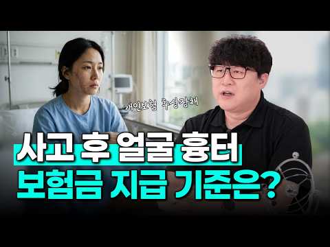 얼굴흉터 개인보험 추상장해는 어떻게 평가될까?(1902회)