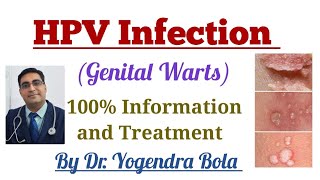 HPV Infection (Genital Warts) Ke Causes,Symptoms and Treatment ||Gardasil Vaccine For HPV Prevention