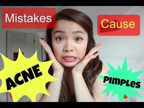Những Sai Lầm Gây Ra Mụn - Mistakes That Cause Acne | TrinhPham