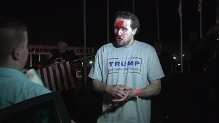 Trump Supporter Relives California Protest: Blood Was Flooding Down My Face