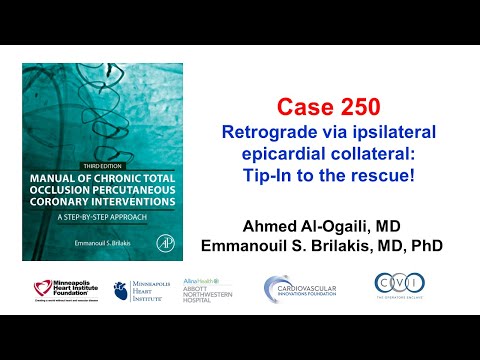 Case 250: Manual of CTO PCI - Retrograde via ipsilateral epicardial collateral: tip in to the rescue