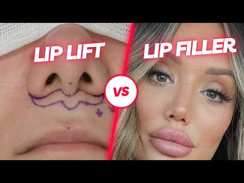 Lip Lift Surgery vs. Lip Fillers