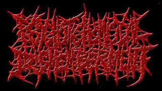 Psychotic Homicidal Dismemberment - Deep Post Mortal Torso Stab Wounds and Laceration