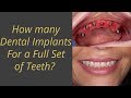 How many implants are needed to replace a full set of teeth?