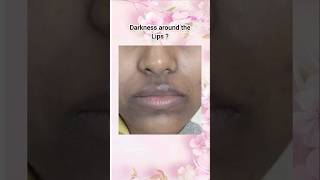 Solution of Darkness Around Mouth!How to remove dark patches on skin #fyp #shorts #shortfeed #kpop
