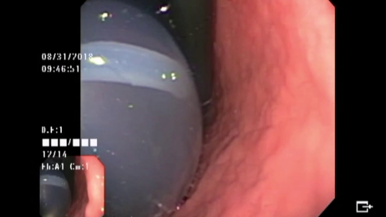 Adriana Fabiola Romano Munive-22