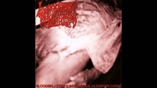 Lymphatic Phlegm - Bloodsplattered Pathological Disfunctions FULL ALBUM (2000 - Patho.Goregrind)
