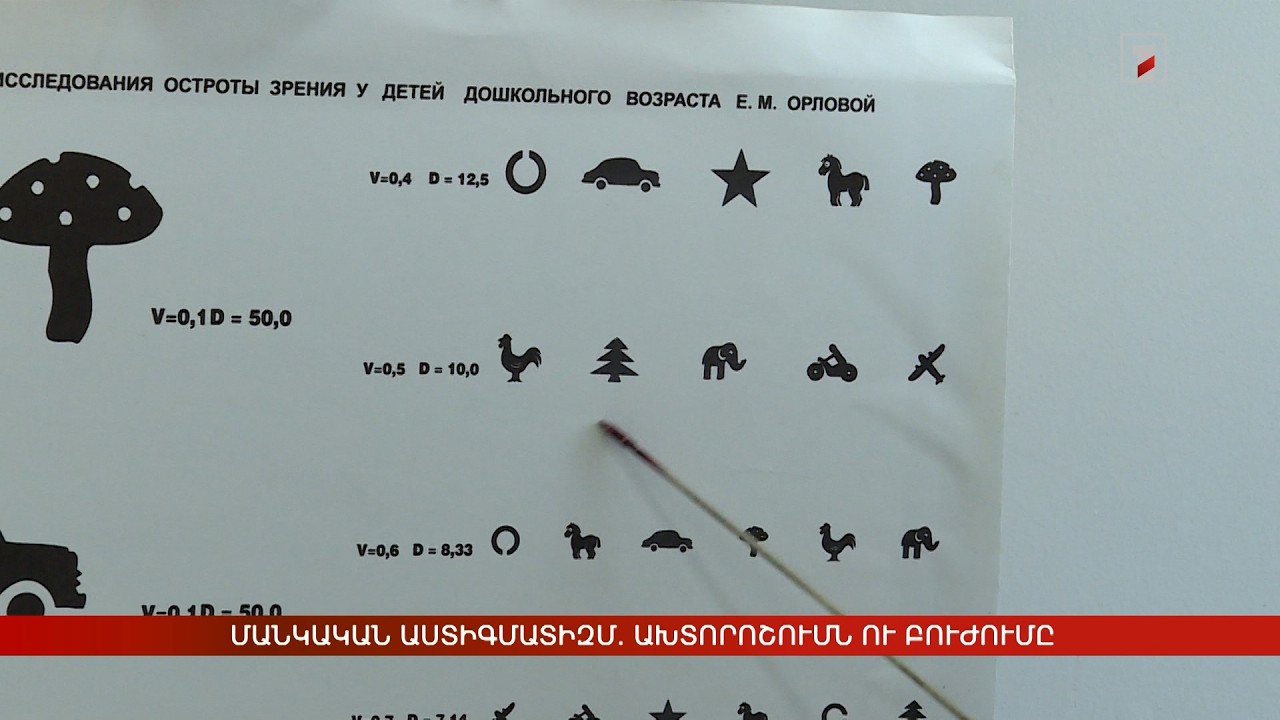 Մանկական աստիգմատիզմ. ախտորոշումն ու բուժումը
