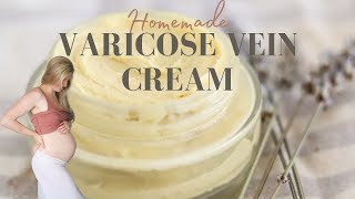 Homemade Varicose Vein Relief Cream | How I made my life easier!