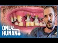 I Haven't Visited the Dentist in 10 Years | Britain's Worst Teeth | Only Human