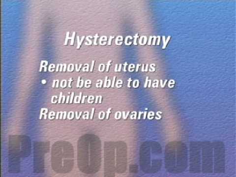 Hysterectomy Removal of Uterus, Ovaries and Fallopian Tubes Patient Education
