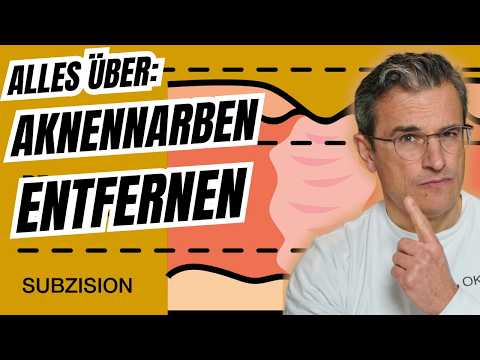 Aknenarben endlich verbessern: Kombitherapie erklärt 🔬✨ Dr. med. Robert Kasten