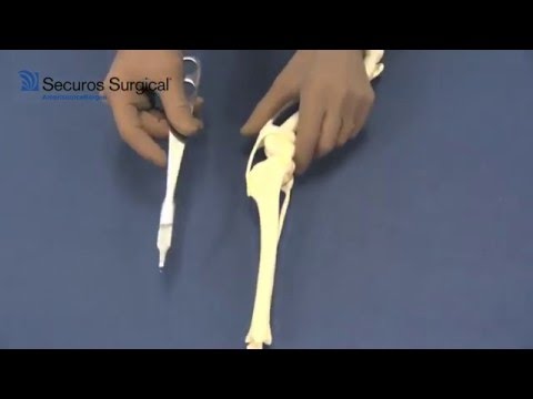 Securos Surgical - Instrumentation: Hohmann Retractor