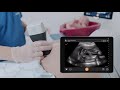 Gender Identification Ultrasound Scanning Technique