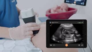 Gender Identification - Ultrasound Scanning Technique