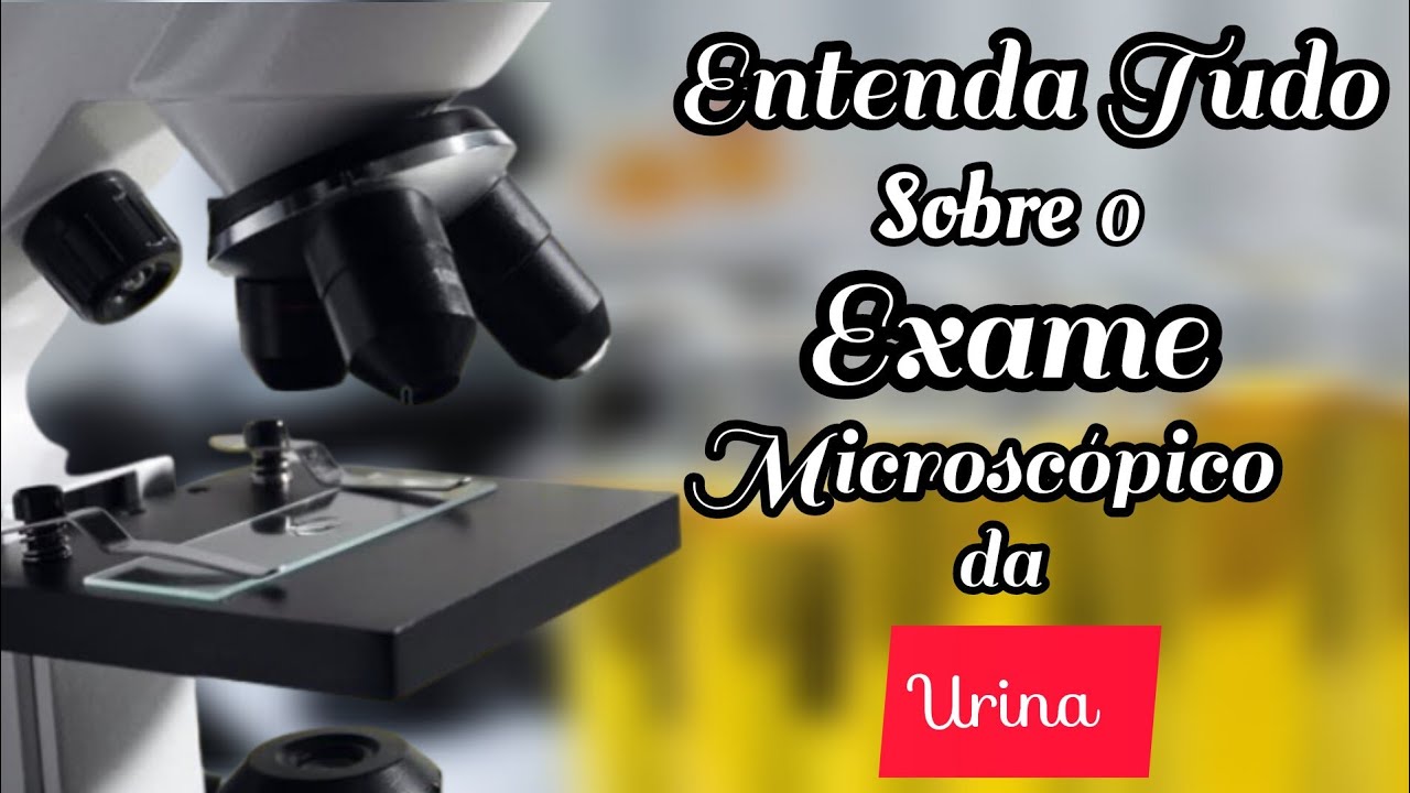 Entenda tudo sobre o Exame microscópico da Urina