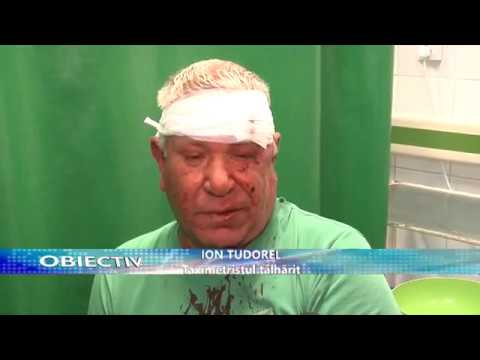 Știre Etv/25.04.2017 – TAXIMETRIST BĂTUT DE CLIENT