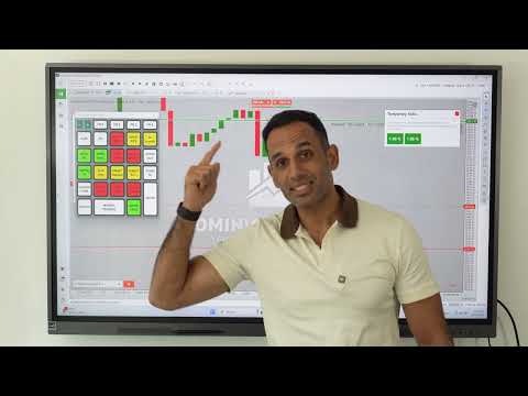 Why I don't use basic Risk:Reward