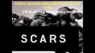 Alesso  ft Ryan Tedder - Scars - Sub español