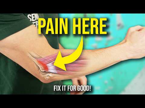 How to Fix Lateral Elbow Pain (Tennis Elbow) in 26 Minutes!