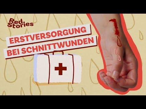 Wenn’s blutet: Erste Hilfe bei Schnittwunden