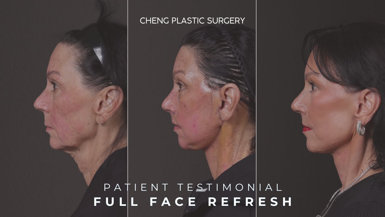 Cheng Plastic Surgery