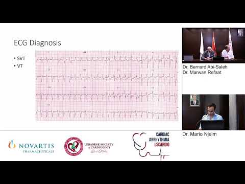 CARDIAC ARRHYTHMIA FULL WEBINAR SEP 30