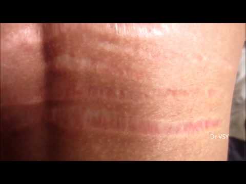 download lagu mp3 mp4 Striae, download lagu Striae gratis, unduh video klip Striae