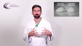 Implante mamario ¿Anatómico o Redondo ¿Cuál es mejor ★ Clínica Menorca