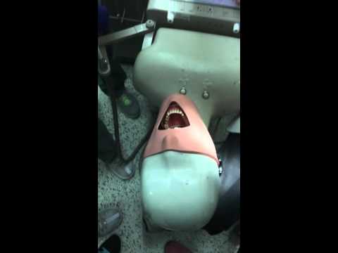 Fixed prosthodontics crown prep 46 gold (all metal) crown