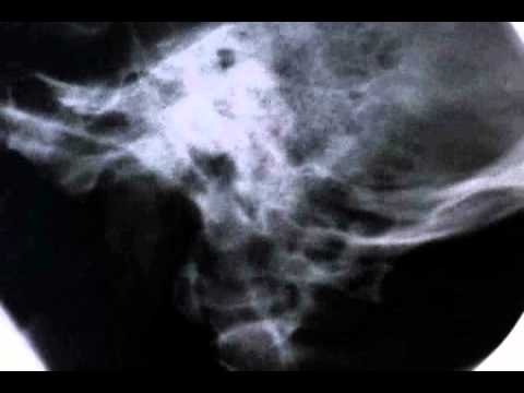 Diary of One Day - Thirty-Two Short Films About Glenn Gould