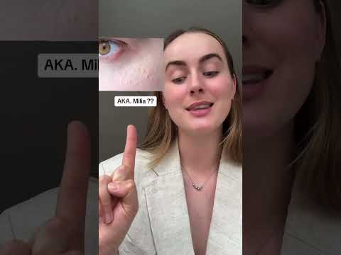 My best kept milia tip AND stop using products with oil in it! #milia #skincare #skintips #retinol