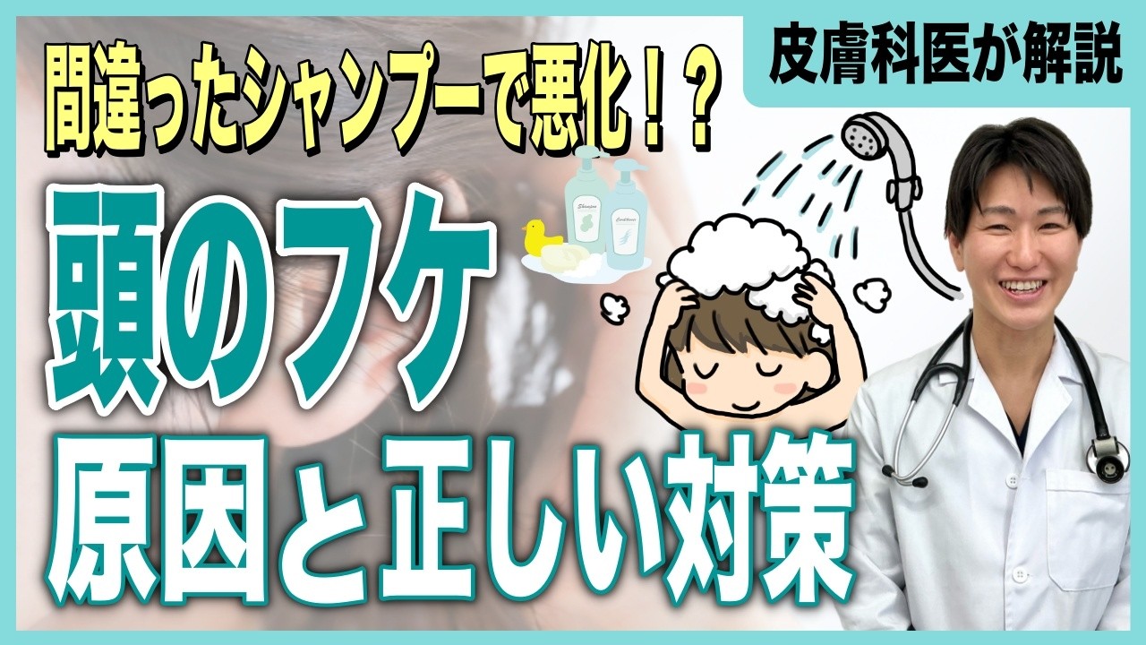 脂漏性皮膚炎について医師が解説