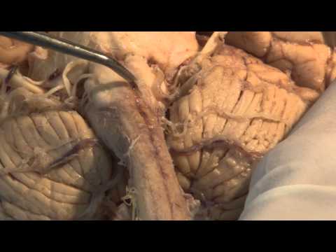 The Most Important Pathway: Motor Control: Neuroanatomy Video Lab - Brain Dissections