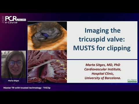 Master TR with trusted technology - TriClip - PCR Valves e-Course 2020
