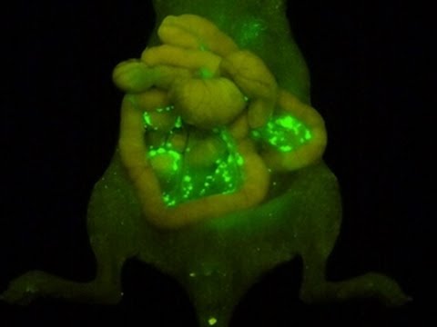 がん研究における画期的な進歩: 研究者らが画期的な早期警告システムを開発