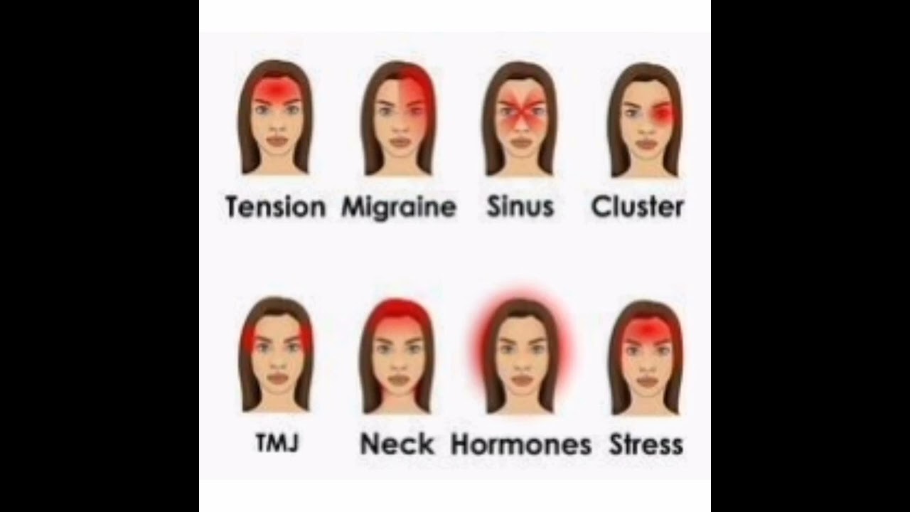 Premium vector/types of headache illustrated on women face 🤕#shorts