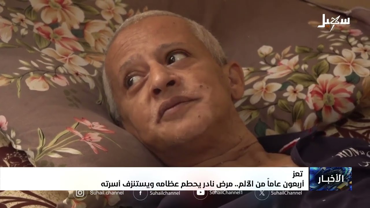 أربعون عاماً من الألم .. مرض نادر يحطم عظامه ويستنزف أسرته