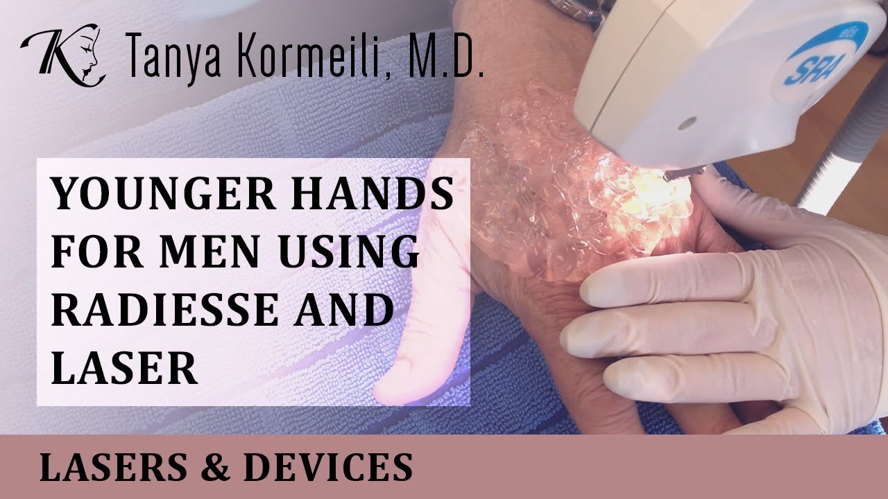 Best Liver Spots Treatment Los Angeles Santa Monica Dr Tanya Kormeili Dermatology